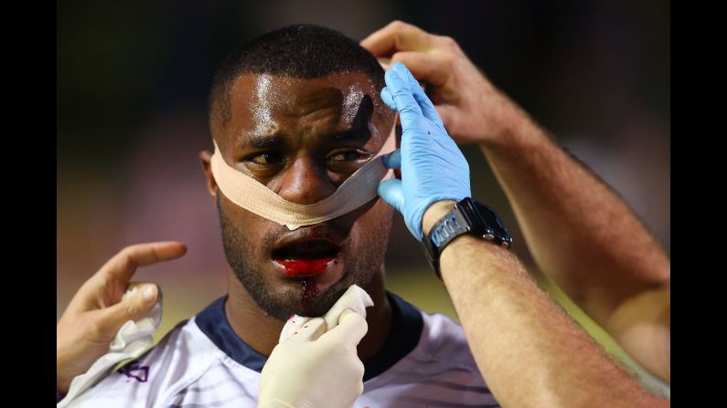 Suliasi Vunivalu of the Storm receives attention after receiving an injury during the round 18 NRL match between the Manly Sea Eagles and the Melbourne Storm at Lottoland on Saturday, July 14, in Sydney, Australia. 