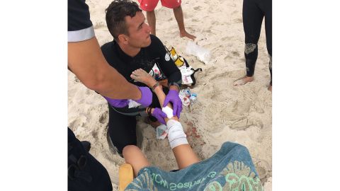 Lola Pollina has her leg wrapped after being bit by a shark on Wednesday, June 18 on Fire Island in New York.