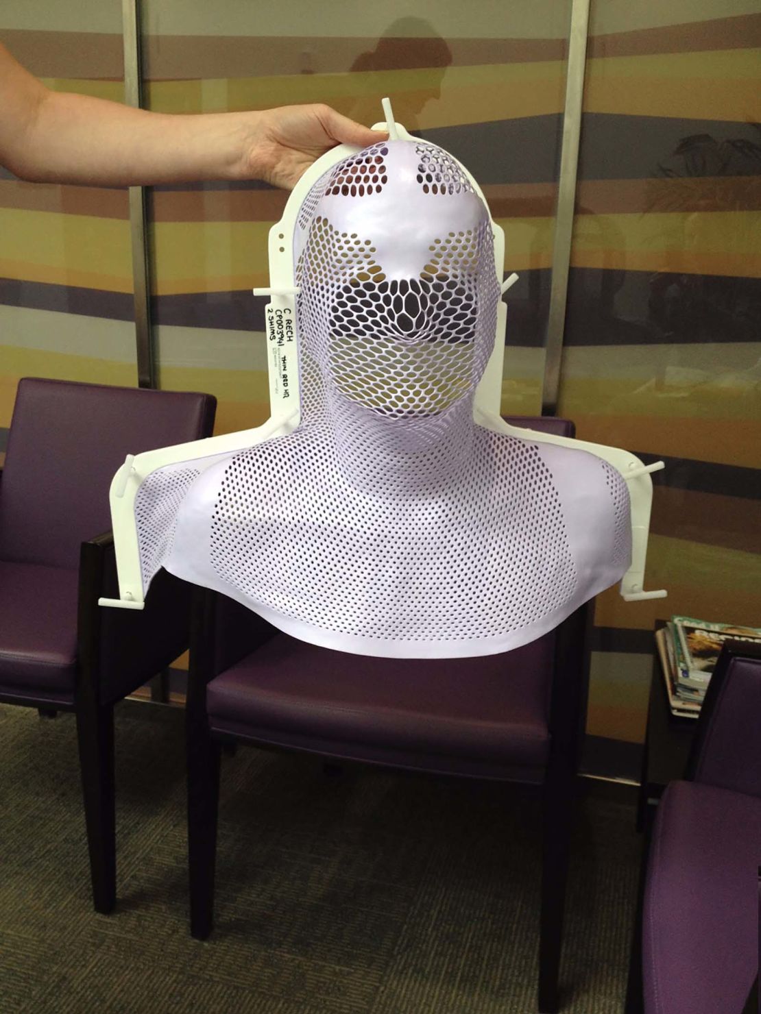 Phil Rech's radiotherapy mask was molded to his face.