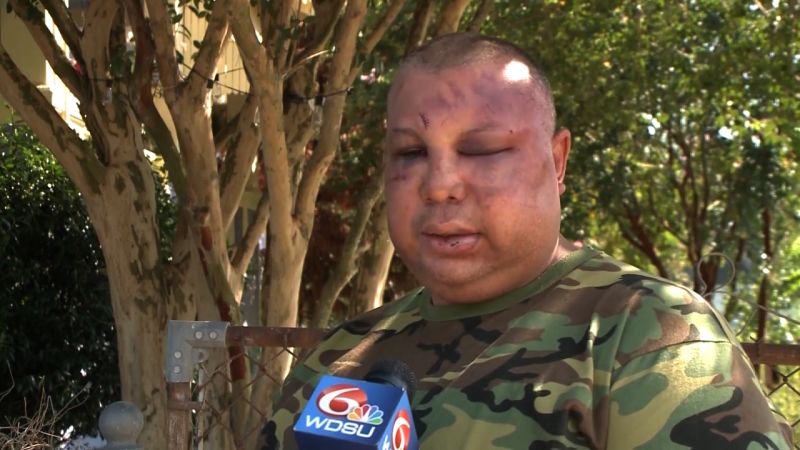 2 police officers arrested after allegedly beating a man | CNN