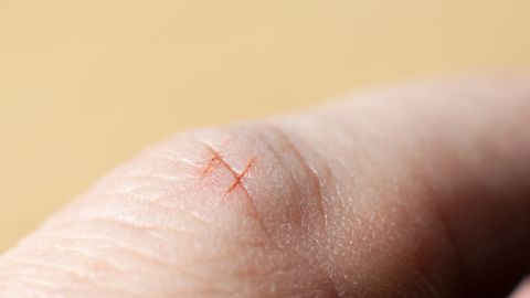 Wash a paper cut as soon as you can with soap and water to prevent infection.