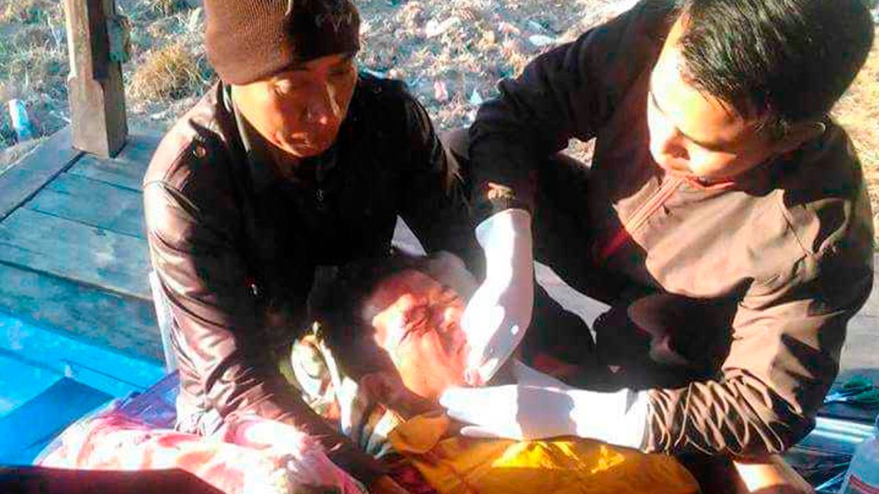 Medics treat an injured earthquake victim in Sembalun, East Lombok.