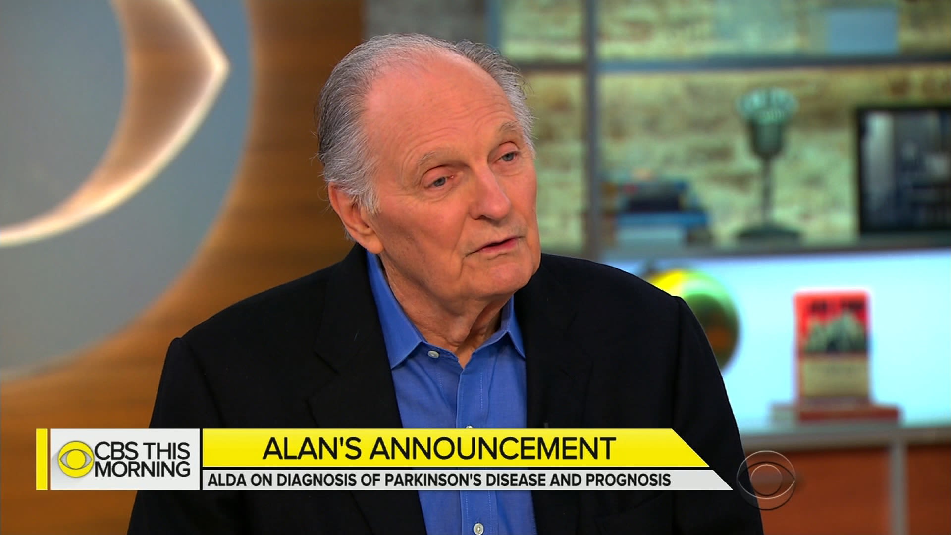 Doc: Alan Alda doing right thing staying active – Boston Herald