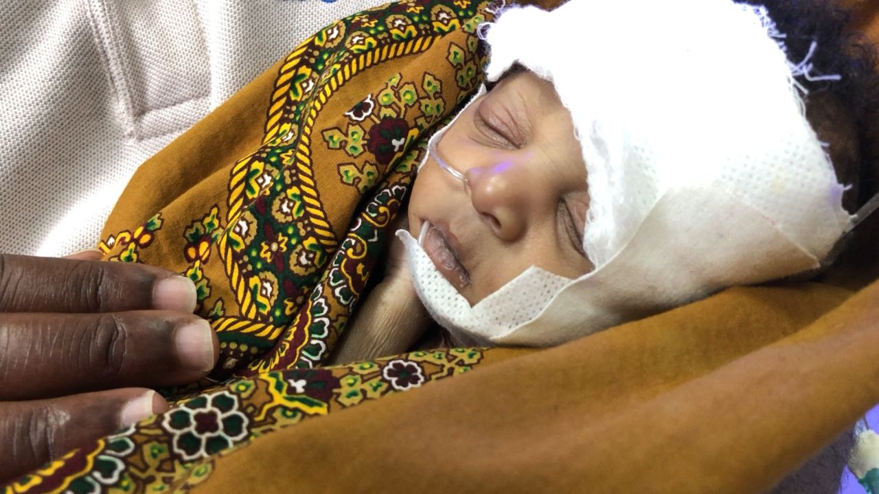 Abigail Matchaya weighed just 3 pounds at birth, having been born prematurely, and soon developed sepsis.