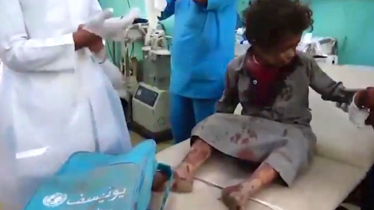 The boy is treated in a hospital after the strike.