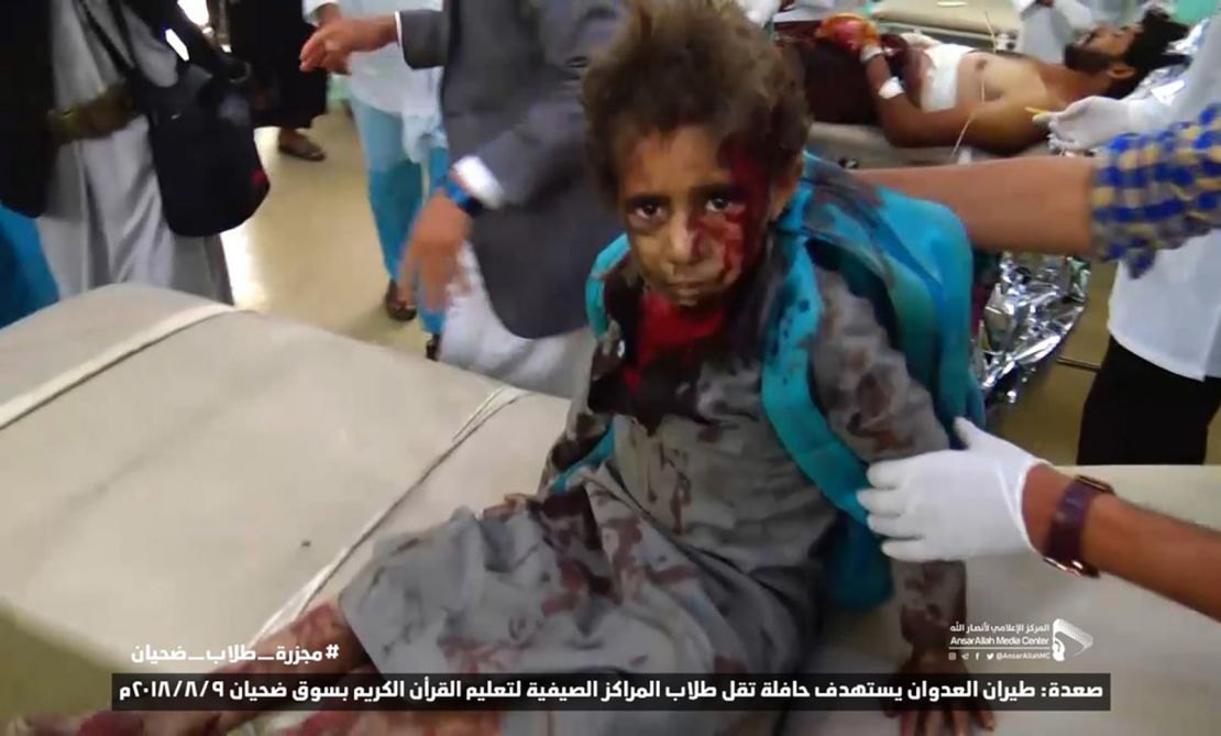 Footage from Houthi-run Al-Masirah TV appears to show a boy, carrying a UNICEF backpack, being treated for injuries.