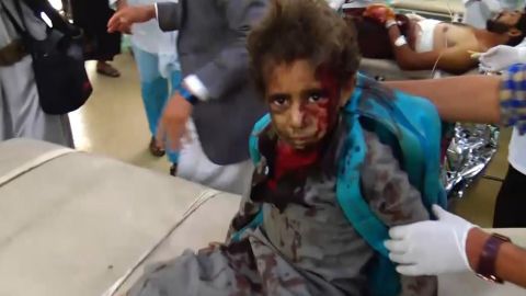 Footage from Houthi-run Al-Masirah TV appears to show a boy, carrying a UNICEF backpack, being treated for injuries.
