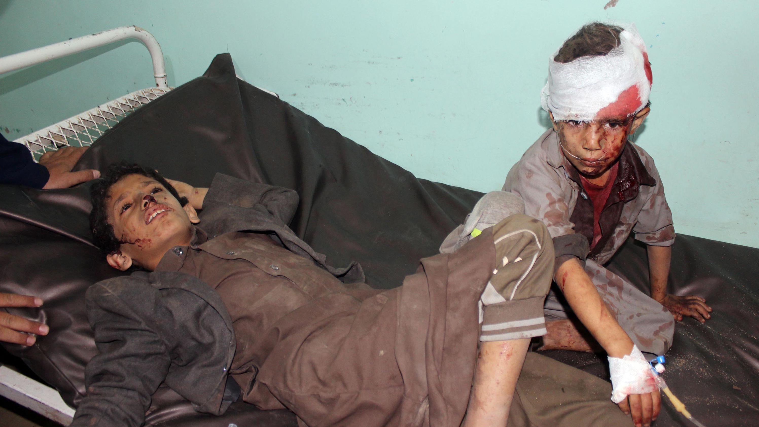 Wounded children in hospital after the attack. 