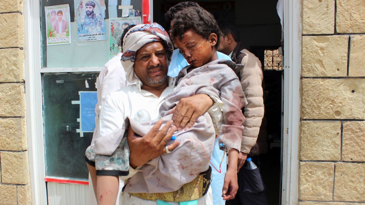 A man transports a child to a hospital after he was wounded Thursday in the strike in northern Yemen.