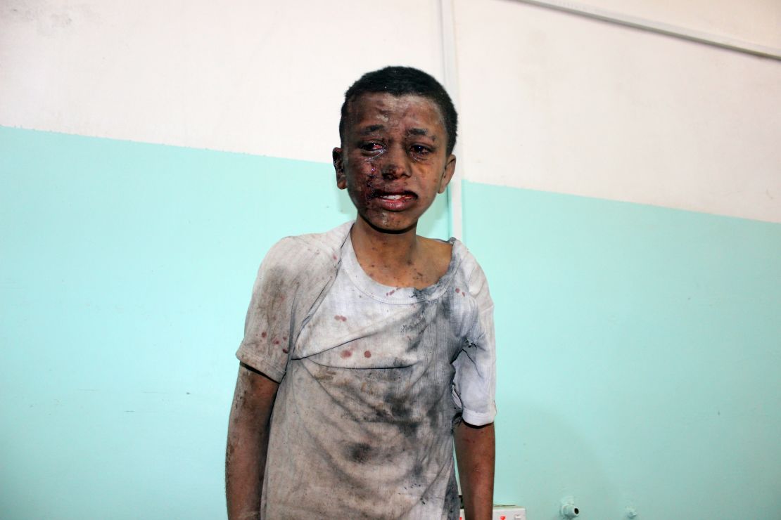  A Yemeni child injured in Thursday's airstrike on a schoolbus.