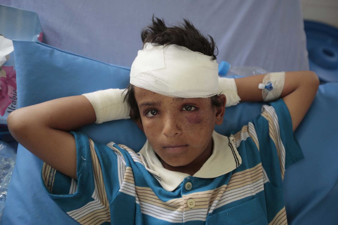 One of the children injured in Thursday's attack. 