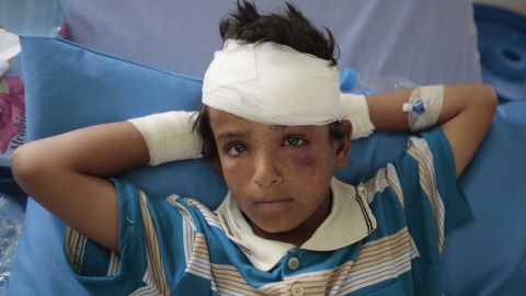 One of the children injured in Thursday's attack. 