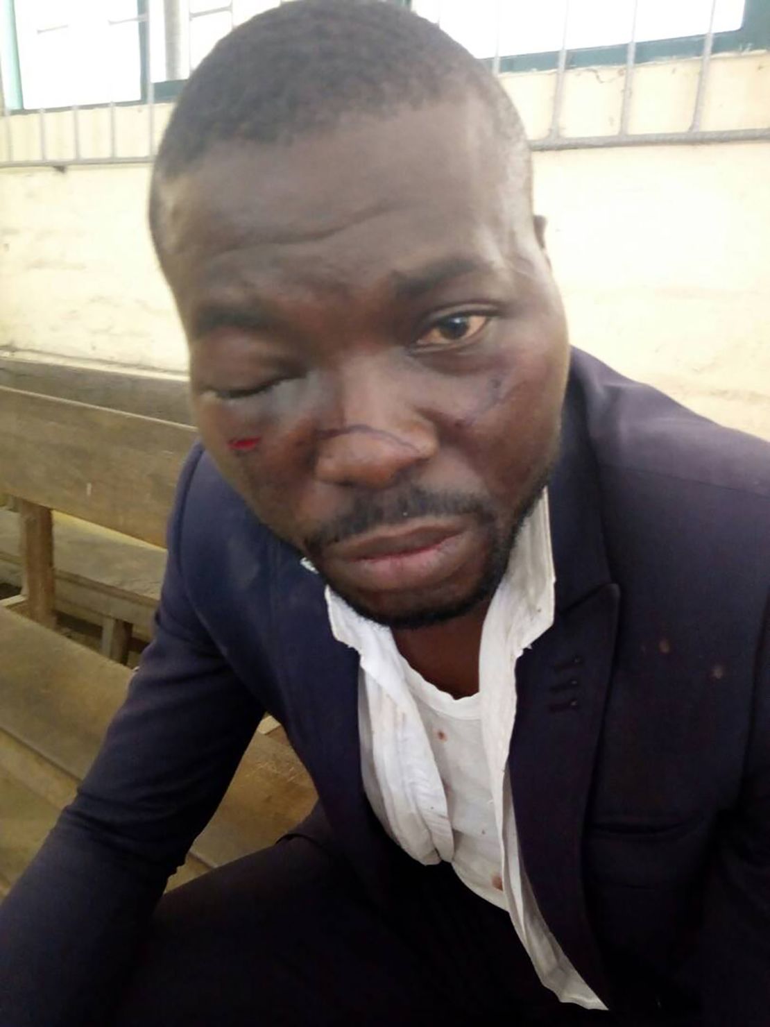 Oyabevwe alleged he was beaten by police officers.