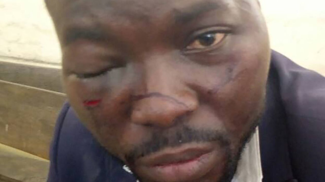 Oyabevwe alleged he was beaten by police officers.