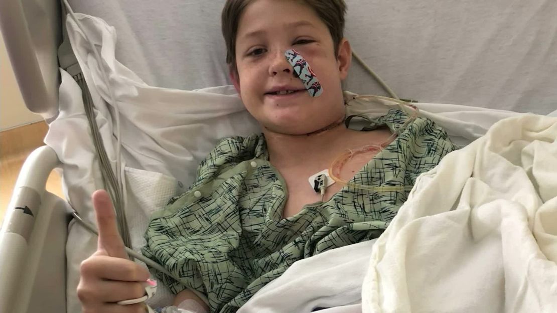 Ten-year-old Xavier survived a penetrating injury to the head by a long metal skewer.