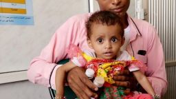 British NGO Save the Children warns that millions of children are at risk of famine in the war in Yemen.