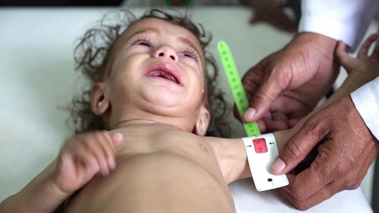 British nongovernmental organization Save the Children has warned that millions of children are at risk of famine in the war in Yemen.