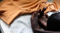 Julia,  a  woman  dying  of  oesophageal  cancer  in  Kimbilio  hospice,  western  Kenya.    
