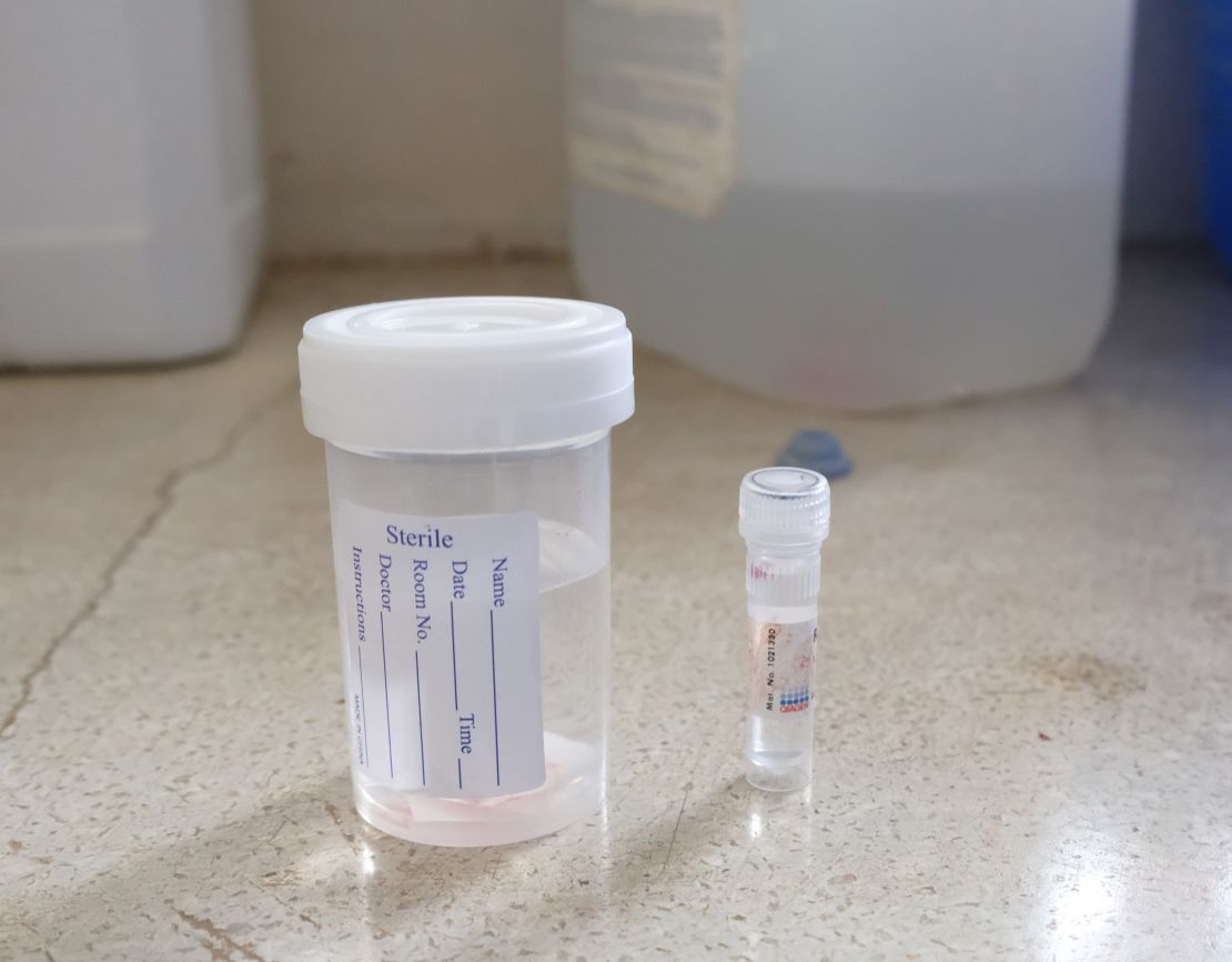 Oesophageal tumour samples taken at Moi Teaching and Referral Hospital, in Eldoret, Kenya.  