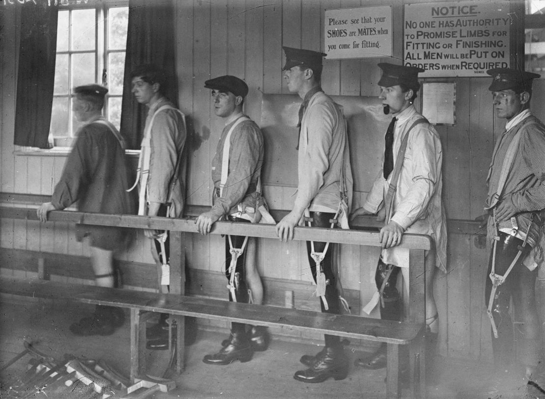 Patients in Roehampton, London being taught to use their new artificial limbs.