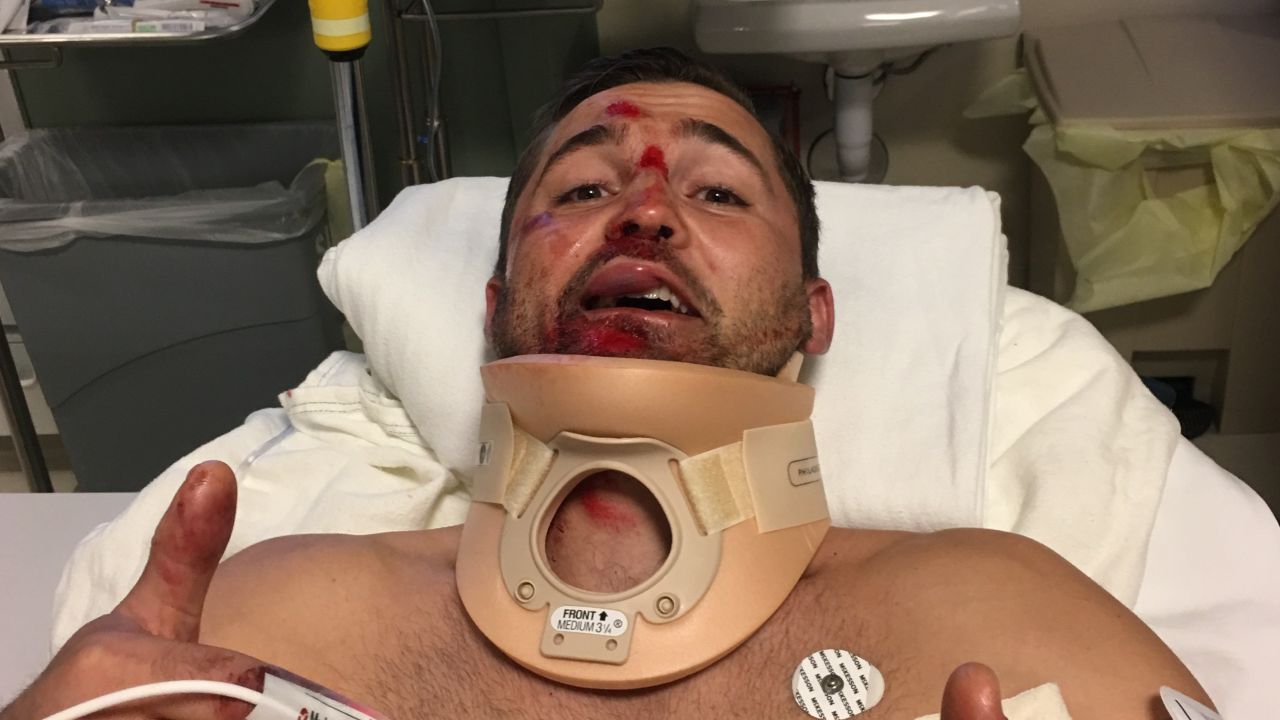 Brandon Nelson, a 32-year-old firefighter, still has wounds on his forehead and had to have his nose reset by an ENT.