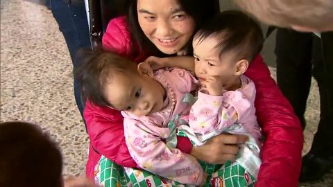 The twins and their mother arrive at Melbourne airport in Australia, where doctors hope to carry out of a life-changing surgery on them.