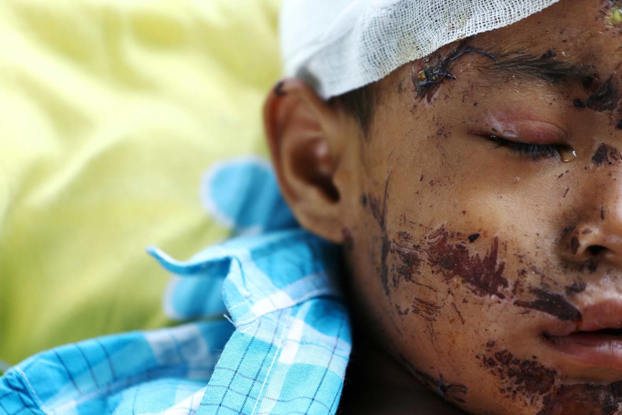 An injured person rests inside a Palu hospital on October 4.