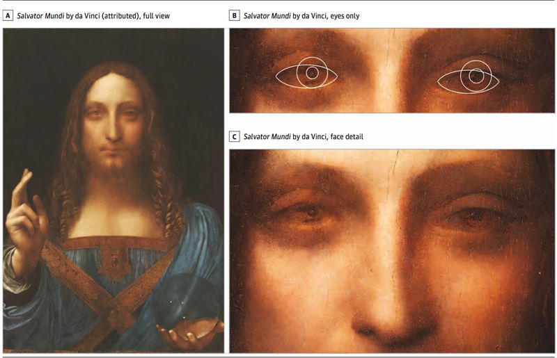 Rare eye condition was behind da Vinci's genius, research
