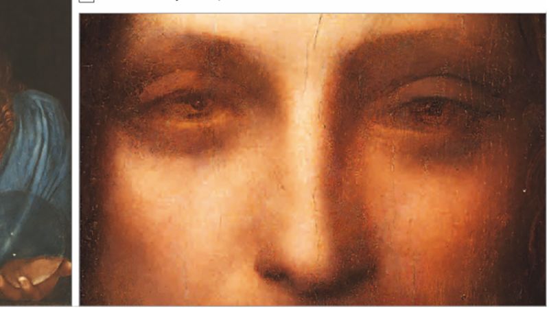 What caused Leonardo da Vinci's hand impairment?