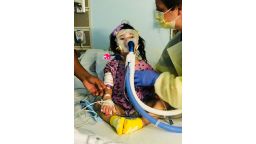 Abigail Palacios, 2, was diagnosed with acute flaccid myelitis.