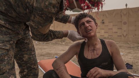 A young SDF soldier receives first aid on the frontline during the operation in Sousa, on October 25.