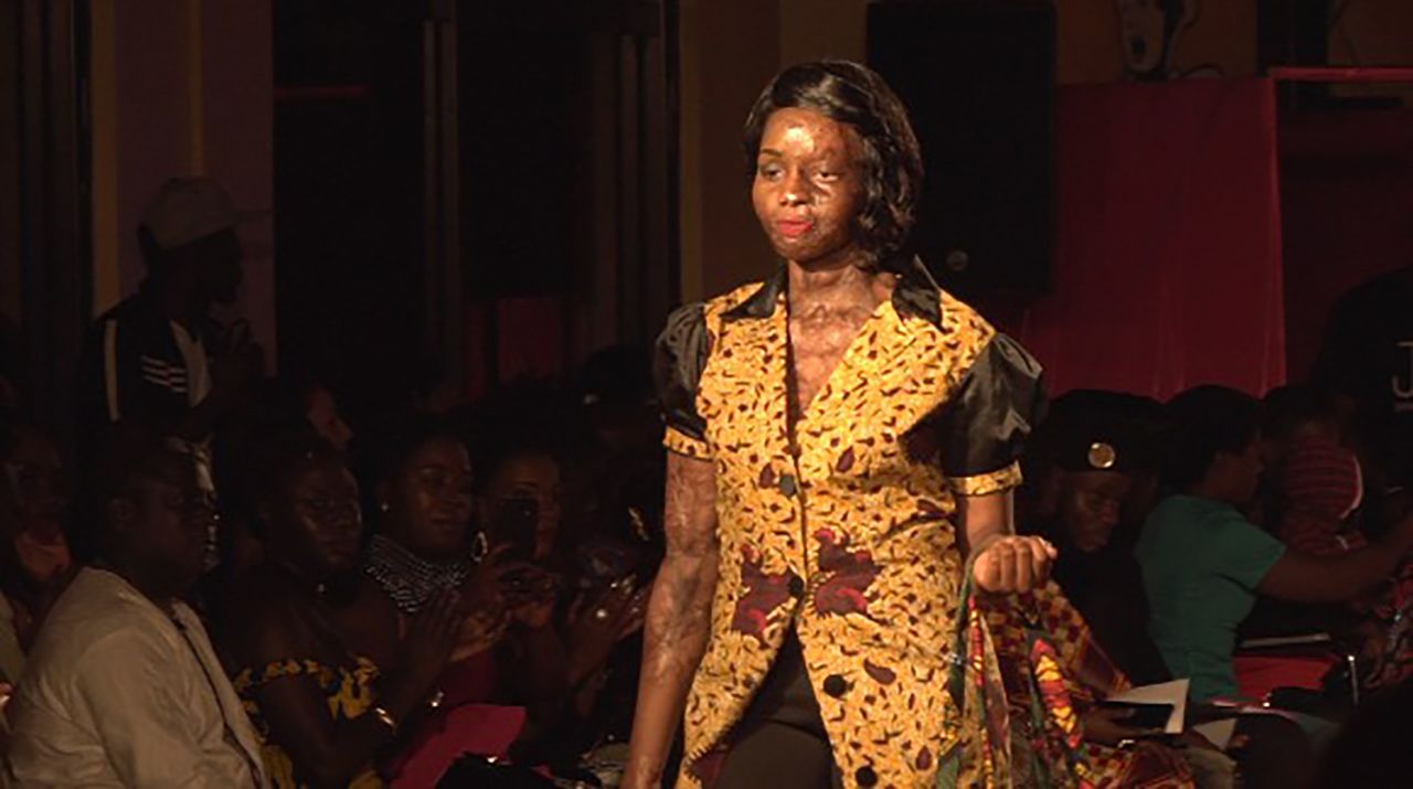 Flavia Nampiima, an acid attack survivor, walks on the runway during the 2018 show in October.