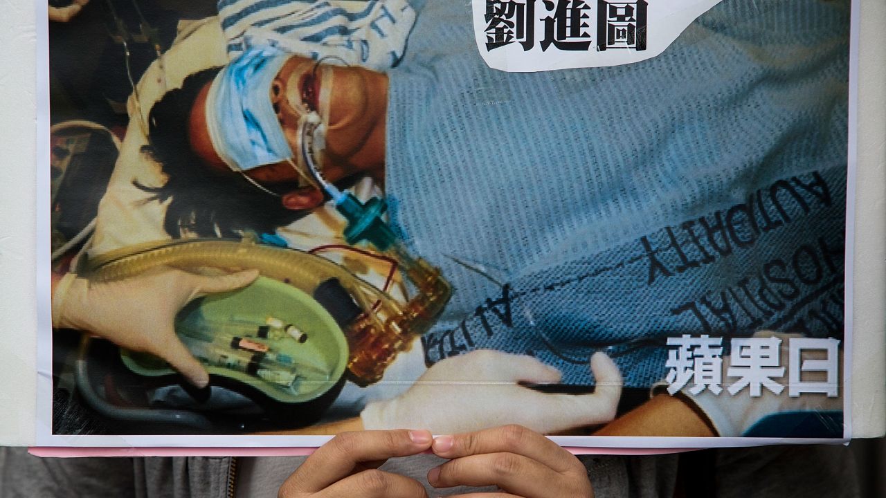 A protester holds a sign showing Ming Pao editor Kevin Lau in hospital after he was attacked in 2014. 