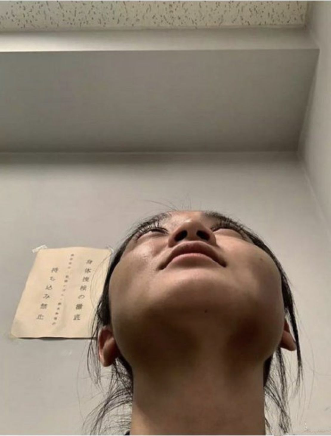An image from Haruka Nakaura's Instagram account, showing bruising on her neck.