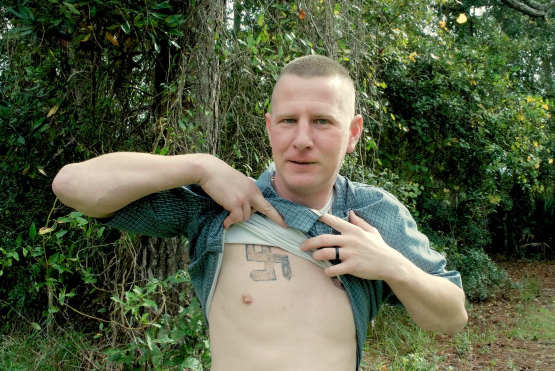 Ken Parker reveals a swastika he had tattooed on his chest when he was involved in the neo-Nazi movement.