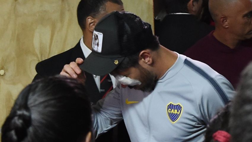 BUENOS AIRES, ARGENTINA - NOVEMBER 24: Pablo Perez of Boca Juniors arrives to Monumental Stadium surrounded by police officers after receiving medical treatment in a hospital due to an eye injury caused by fans that stoned the team's bus and threw tear gas to the players prior the second leg final match of Copa CONMEBOL Libertadores 2018 between River Plate and Boca Juniors at Estadio Monumental Antonio Vespucio Liberti on November 24, 2018 in Buenos Aires, Argentina. (Photo by Marcelo Endelli/Getty Images)