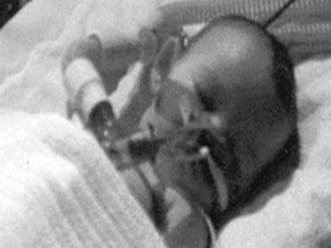 Ashley Rose Murphy spent several months in a coma while struggling with HIV as an infant.