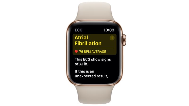 Apple watch best sale with ekg feature