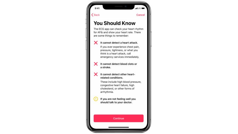 Ekg apple watch online app