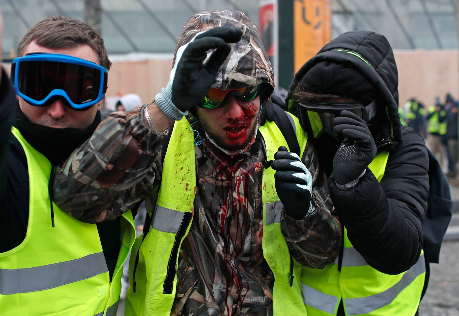 A demonstrator is covered in blood after getting in injured during a protest in Paris on December 8.