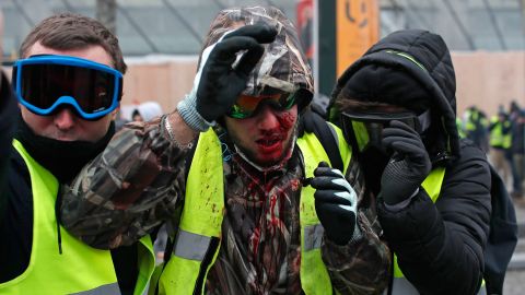 A demonstrator wearing a yellow vest is covered in blood after being injured during a protest in Paris on Saturday.