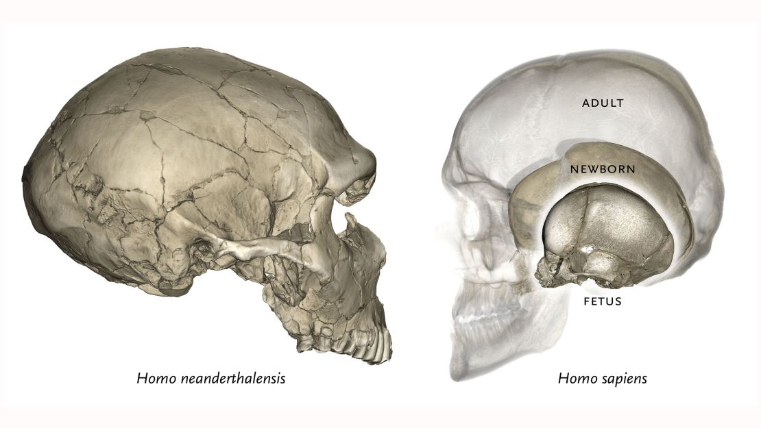 In modern humans the globular endocranial shape emerges soon after birth (just like Neanderthal neonates, modern human babies have elongated braincases and endocrania).