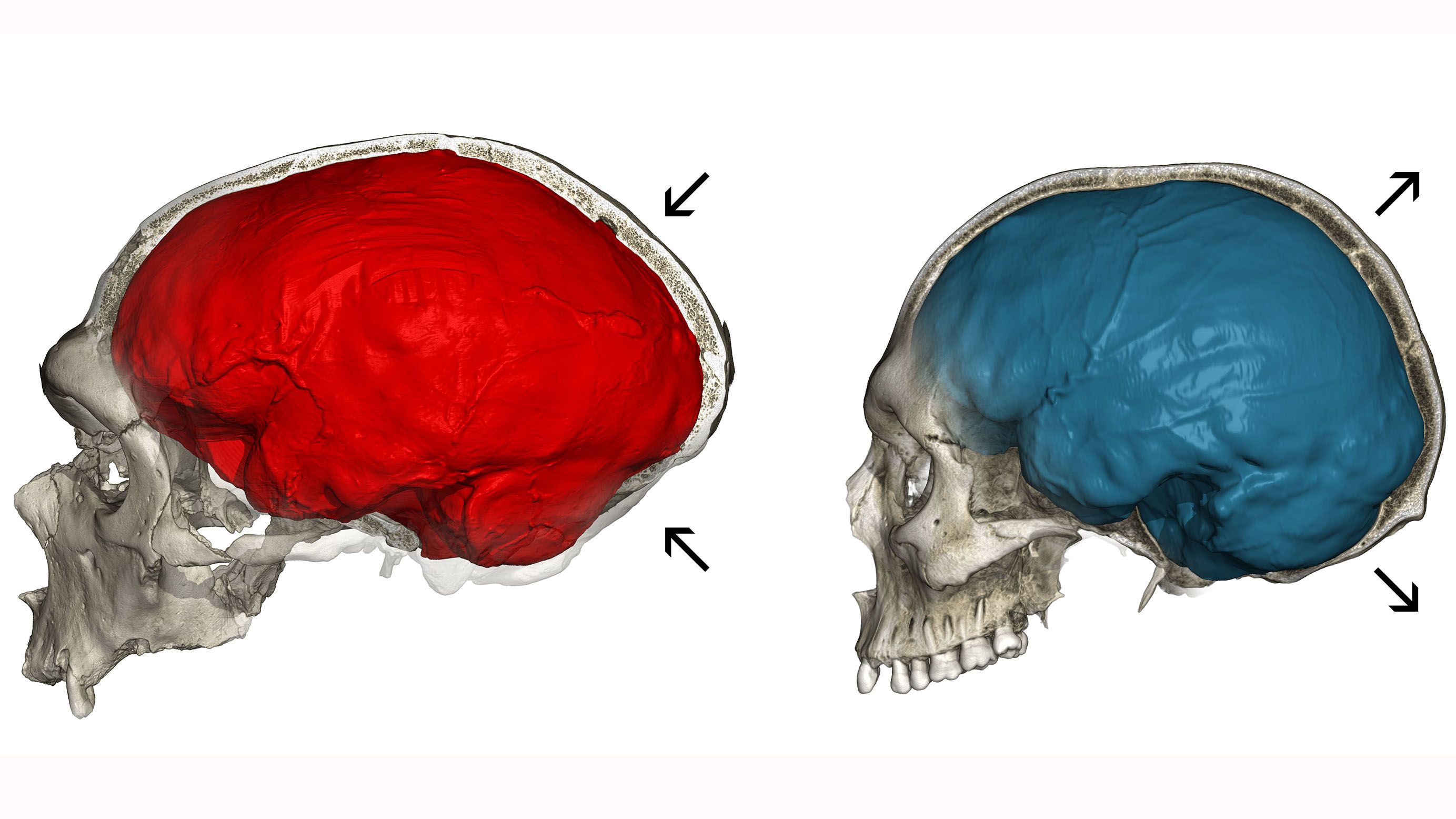 Neanderthal Genes Influence Contemporary Humans' Skull Shape, Brain Size, Smart News