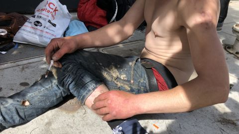 01 sf street drug use