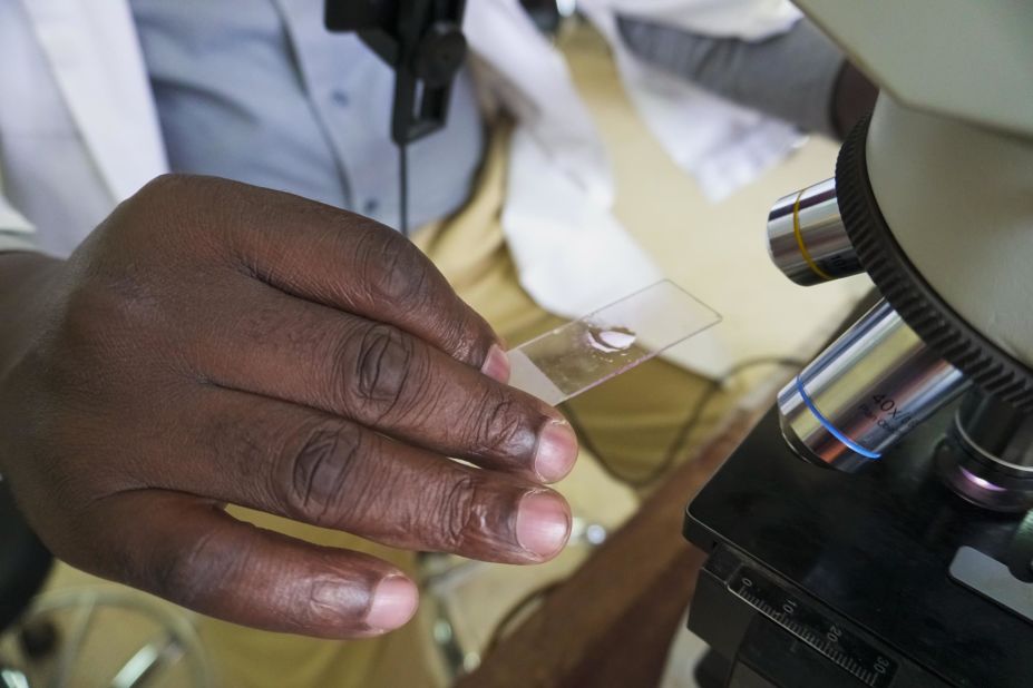 A lab technician at Kiruddu General Hospital in Uganda's capital Kampala examines a microscope slide for malaria.