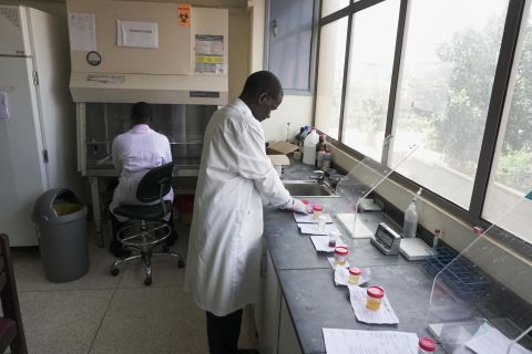 A technician at the diagnostics lab at Kiruddu General Hospital. 