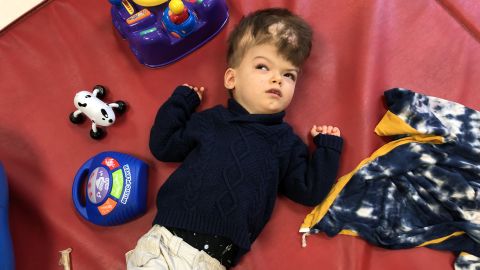 Anias lost most of his function over the last year, but his parents say they've begun to see major progress in the past few weeks.