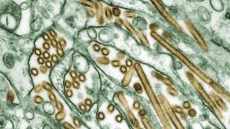在Madin-Darby犬肾（MDCK）上皮细胞中生长的甲型H5N1禽流感病毒颗粒（见金色）的数字着色透射电子显微镜图像（见绿色）。