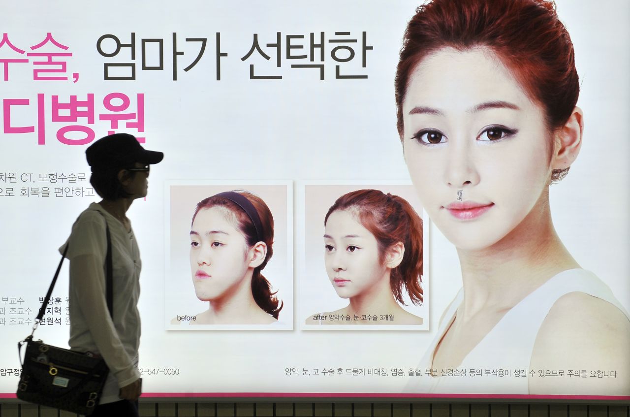 A billboard advertises cosmetic jaw surgery at a subway station in Seoul. 
