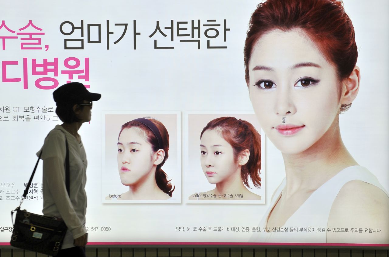 A billboard advertises cosmetic jaw surgery at a subway station in Seoul.